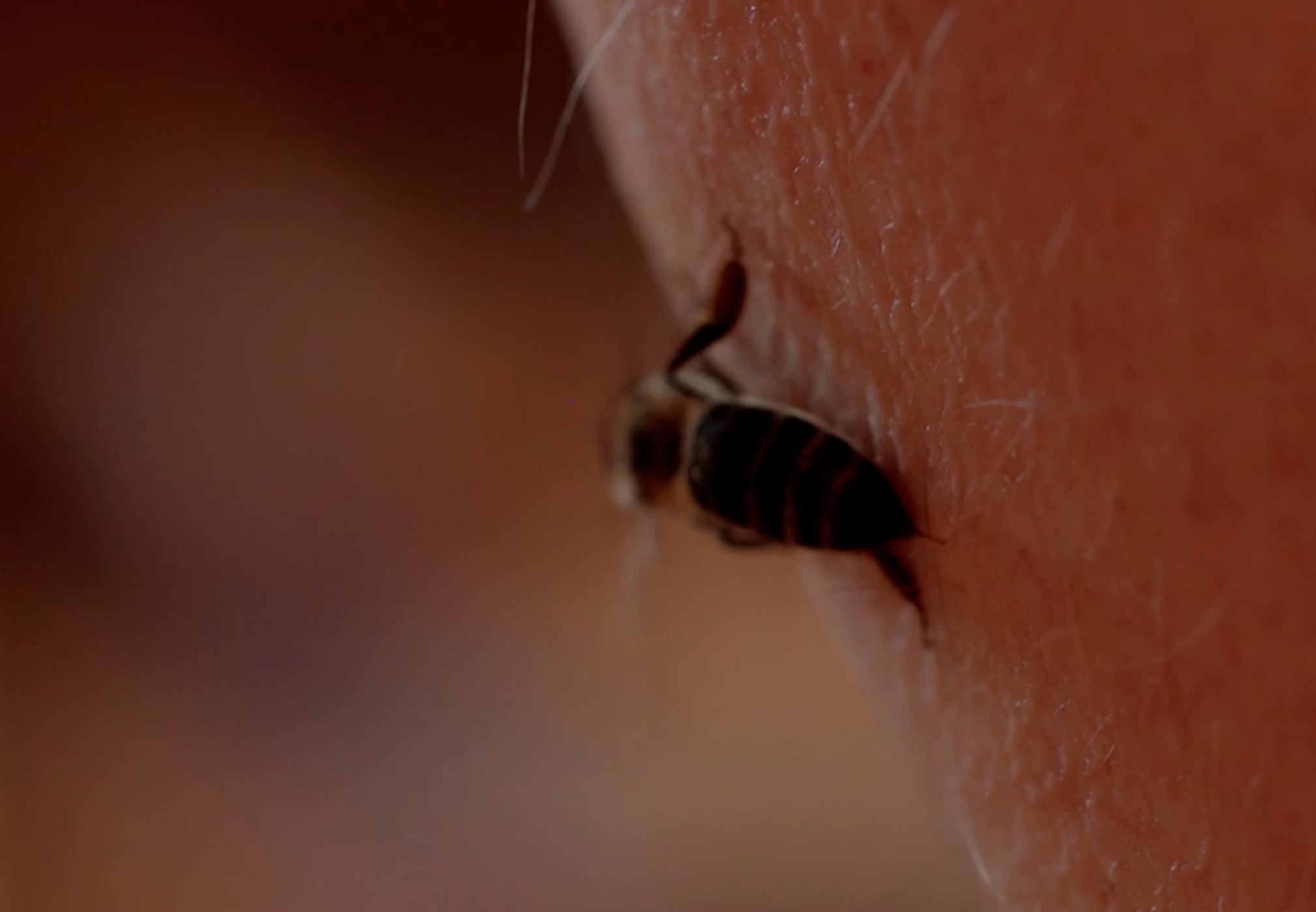 Soft Apipuncture - BeeWisdom | Network of Bee Lovers